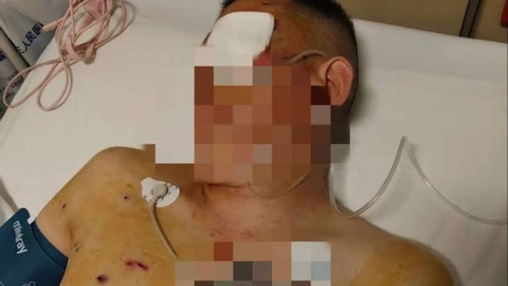 震驚！鄭州男子銀行門前遭搶劫打盲，銀行竟袖手旁觀？