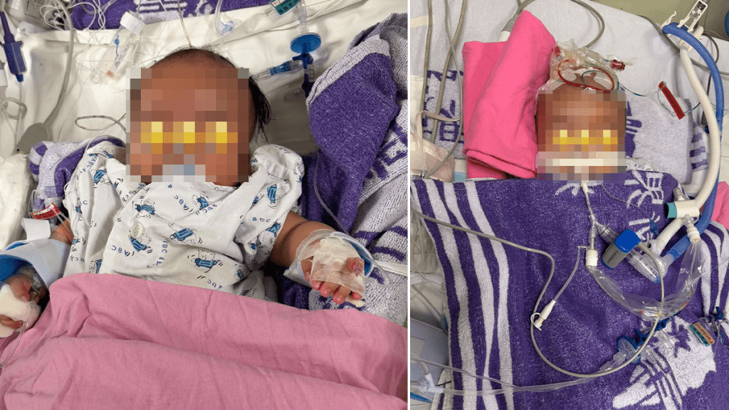 4個月大男嬰腦出血昏迷 父控外傭叉頸搖晃：係謀殺！