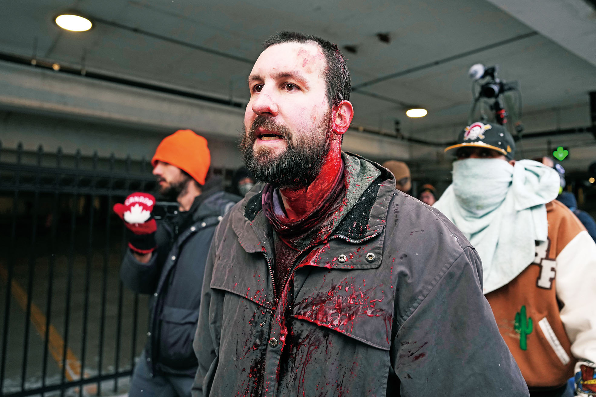 保守派網紅蘭恩的一名支持者頭部流血。美聯社