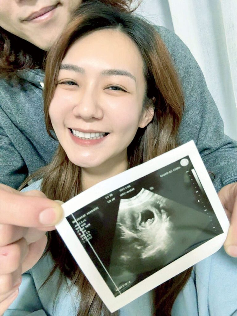 李又汝分享寶寶的超音波照。網上圖片