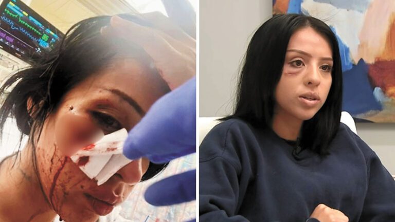 25歲的洛馬斯被一枚非致命性彈藥擊中臉部。ABC 7