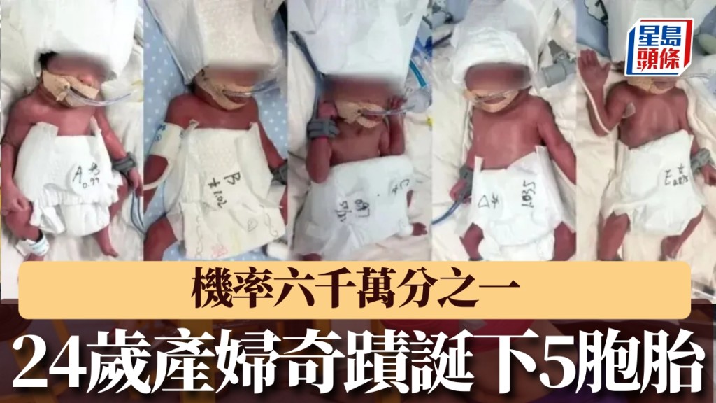 新疆24歲產婦在武漢誕下五胞胎 自然受孕機率極低