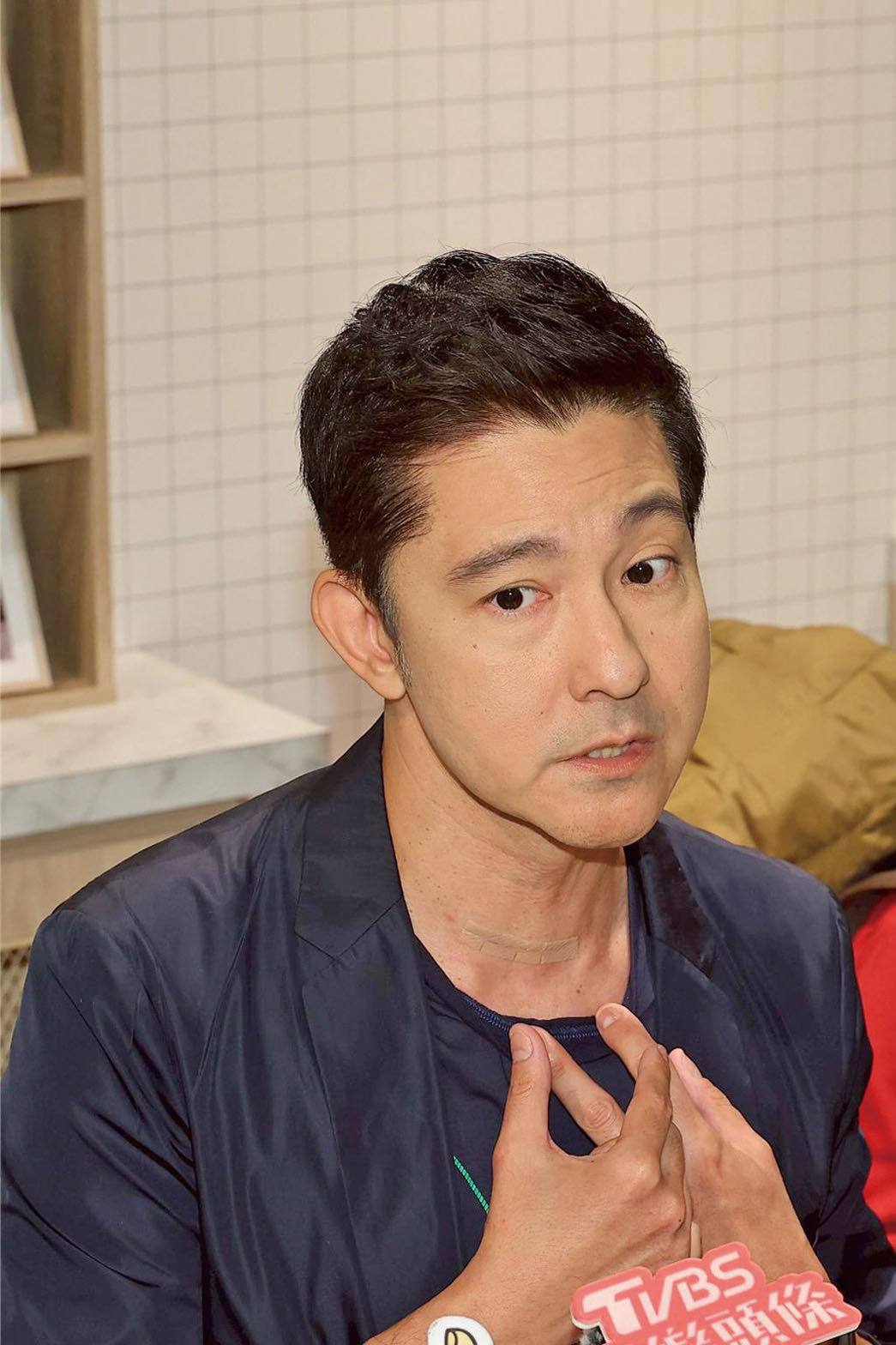 立威廉展出脖子的開刀傷疤。網上圖片 .c3/c4 立威廉去年8月患甲狀腺癌二期，在社交平台發出躺在病床的照片。網上圖片