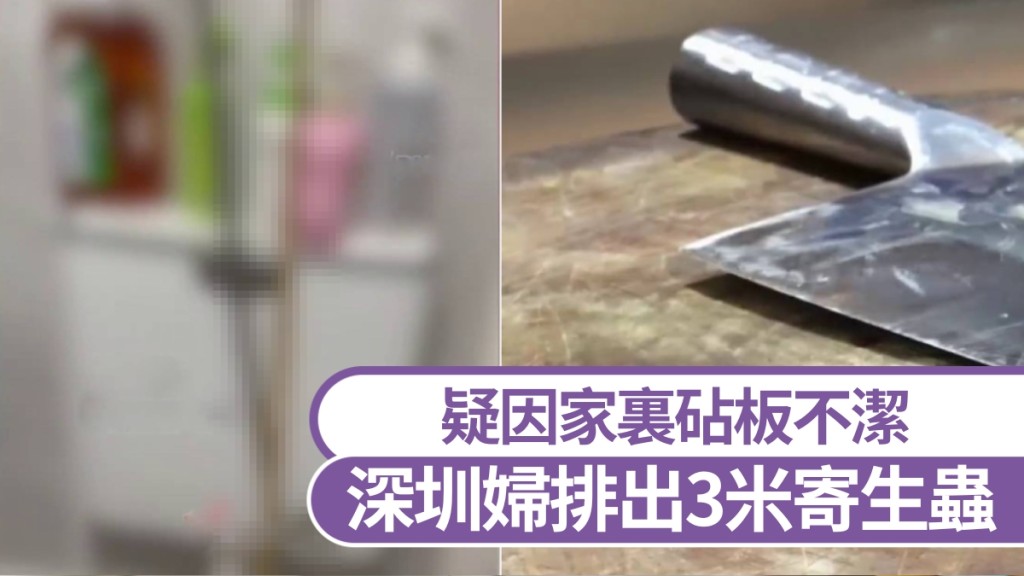 深圳女子如廁驚現3米活蟲！醫生揭禍首：廚房砧板生熟不分