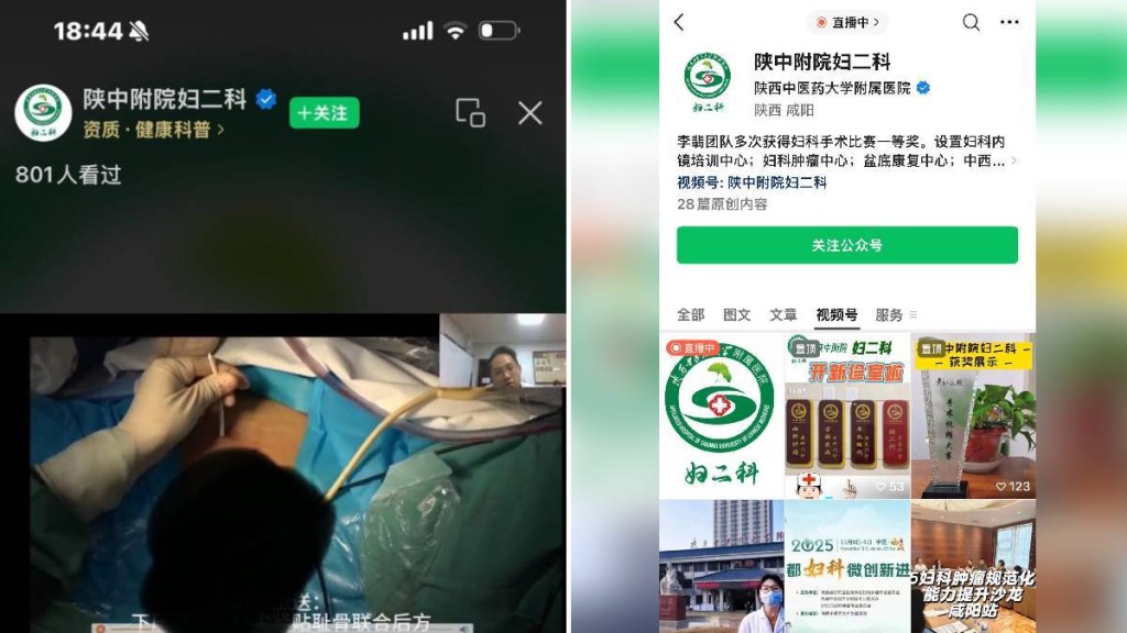 離譜直播！陝西醫院手術過程無遮無掩 女病人私隱部位任睇4分鐘