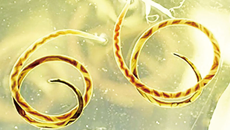 廣州管圓線蟲是一種主要寄生於老鼠體內的寄生蟲，也被稱為「鼠肺線蟲」。CDC