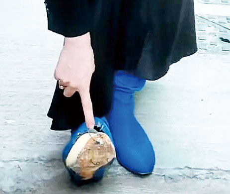 腳趾直接露出，場面十分窘迫。網上圖片