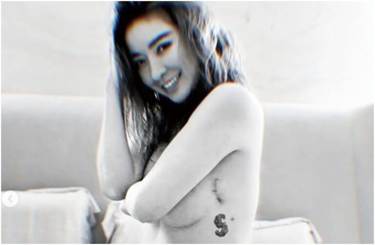 許維恩的手術痕跡清晰可見。網上圖片