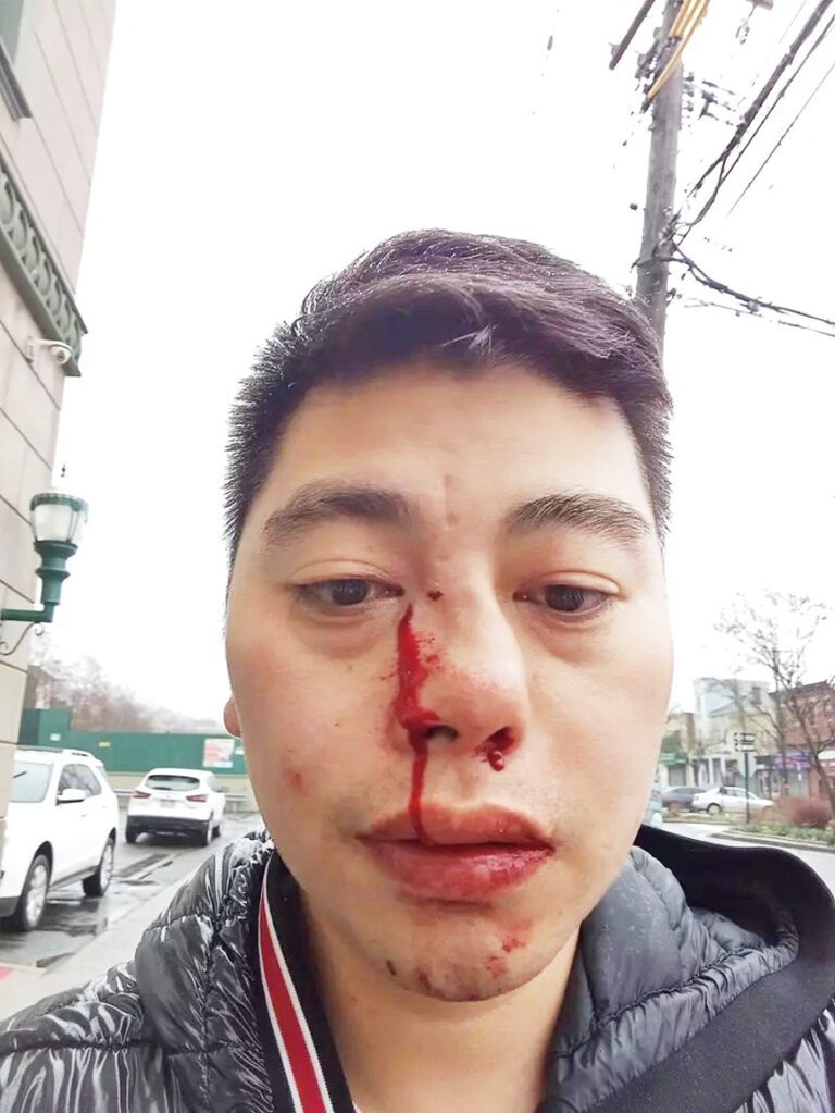 受害者遭重擊後留醫數日出院。