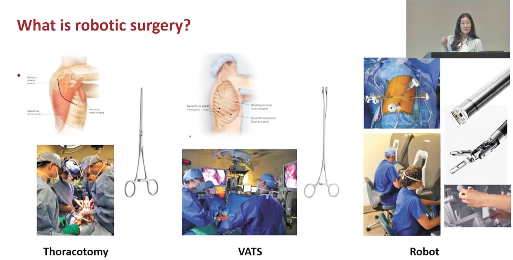 史大採用機器人輔助肺癌手術。記者王蔚攝