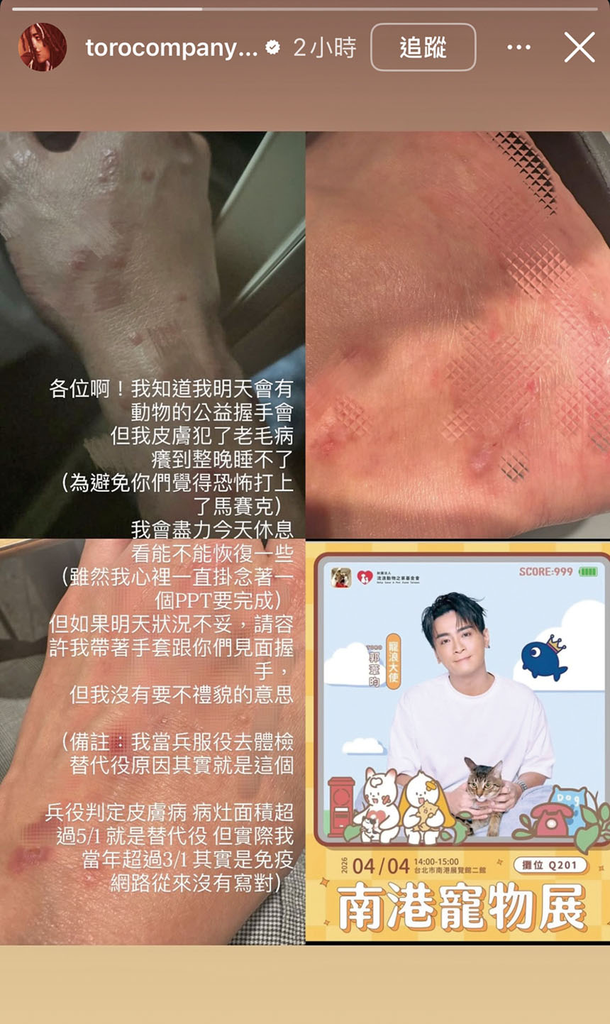 Toro曬出舊疾復發照片。網上圖片