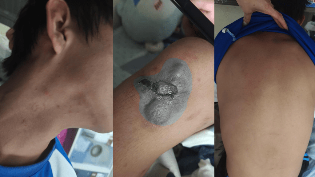 元朗中一男生疑遭童黨勒索及毆打 警方列多項罪名跟進