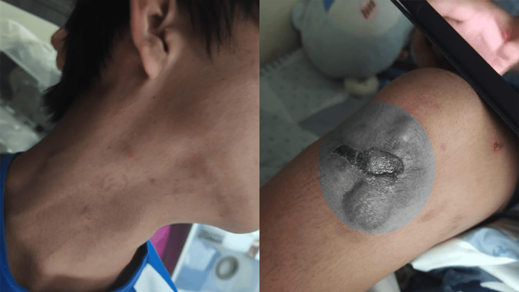 元朗中一男生遭童黨欺凌勒索 警方拘捕6人最細12歲