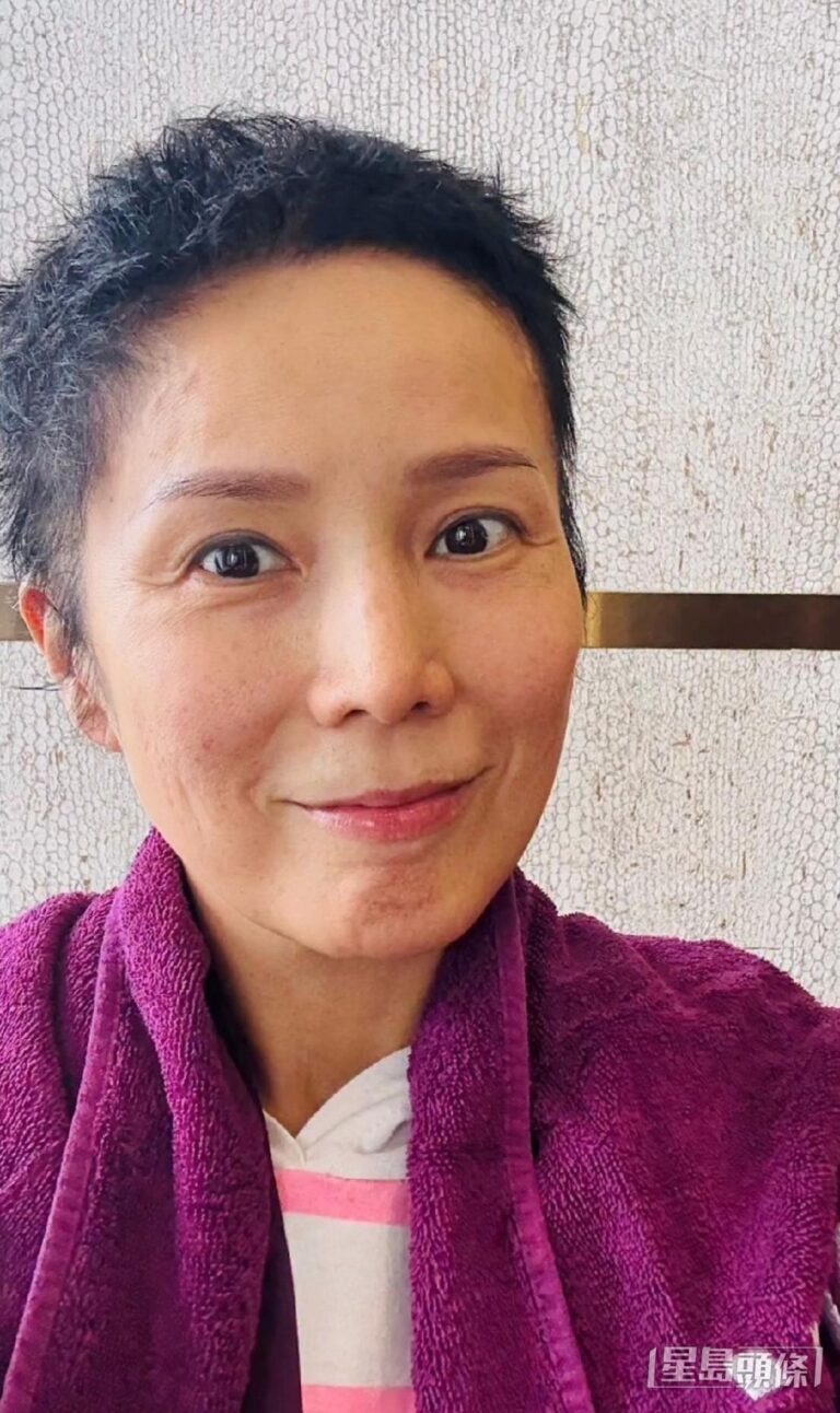 吳文忻化療現肺炎需轉藥 樂觀應對新挑戰 男仔頭造型亮相