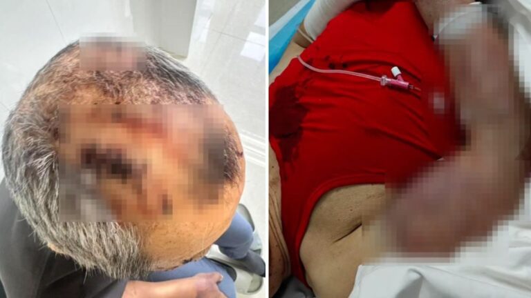 內蒙古養老院發生長者衝突事件 八旬院友涉毆打同房七旬翁致傷