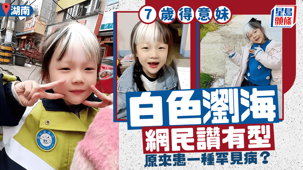 湖南7歲女童天生白色瀏海 罕見斑駁病引發關注
