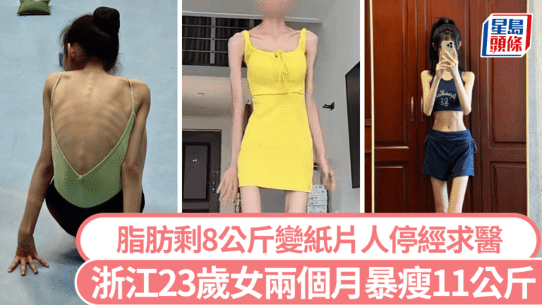 浙江23歲女子盲目注射減肥針 兩個月暴瘦致停經就醫