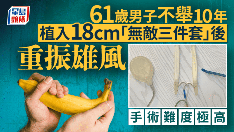 深圳六旬漢成功植入陰莖假體 重獲新生