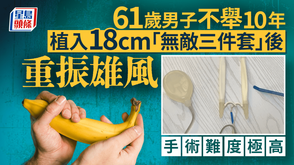 深圳六旬漢成功植入陰莖假體 重獲新生