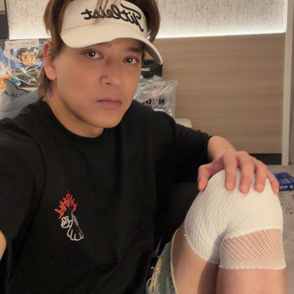 東東早前在排舞熱身時，不慎拉到膝蓋旁的腳筋。
