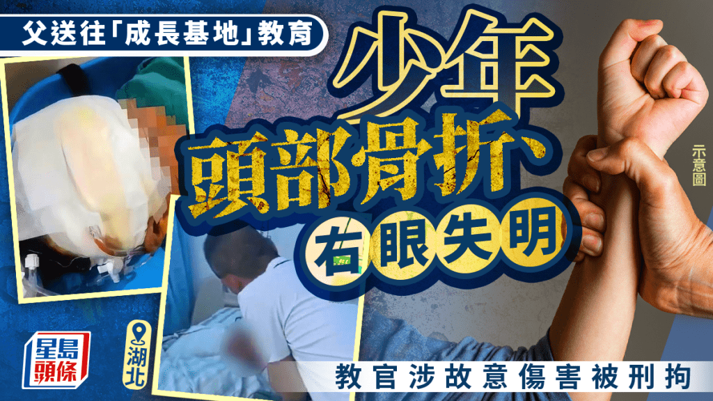 湖北成長基地教官涉毆打學員致重傷 已被刑事拘留