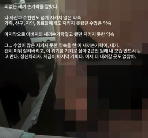 張東周今日在社群平台公開手部傷勢。