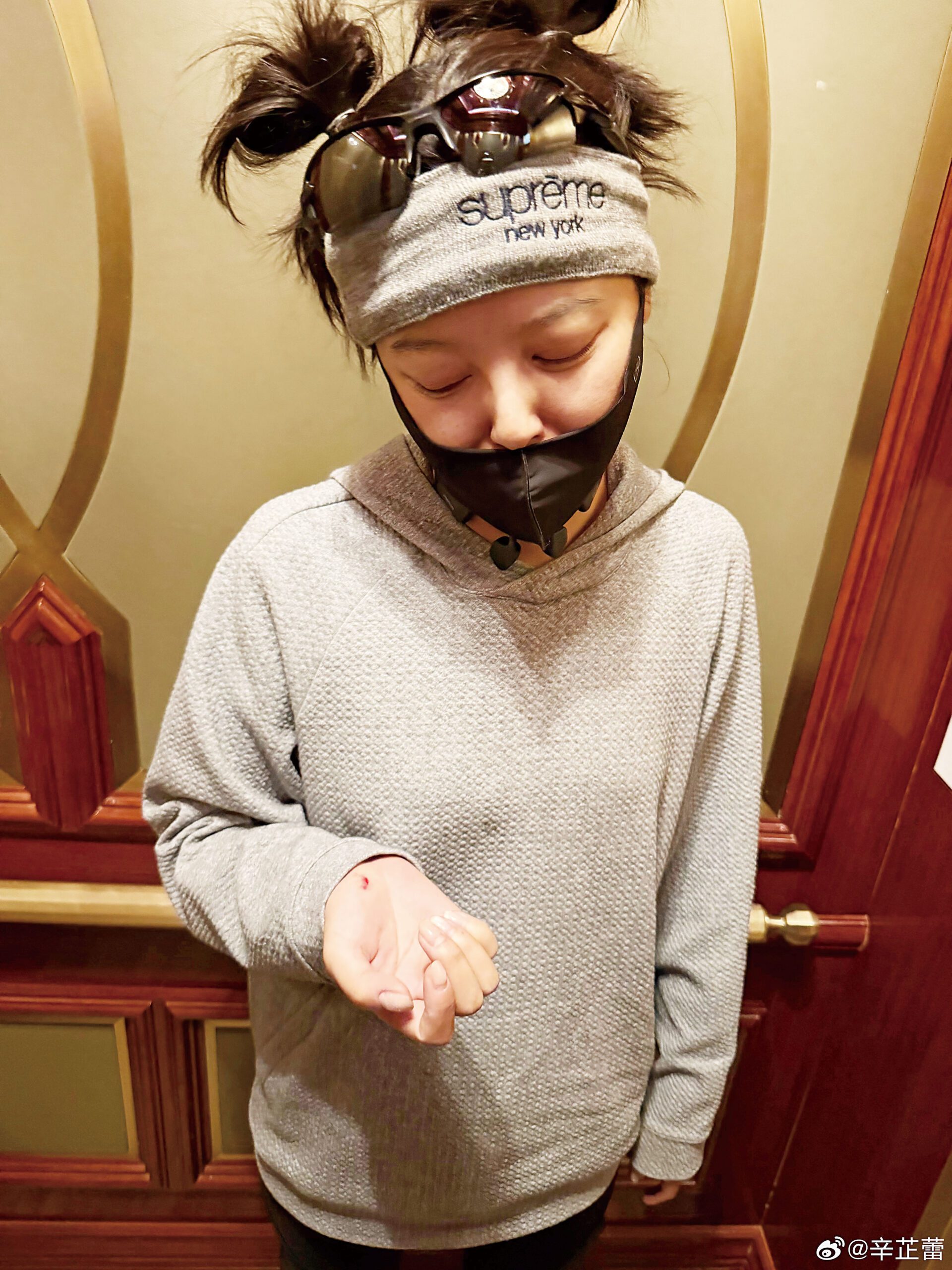辛芷蕾騎行摔倒手破皮。網上圖片