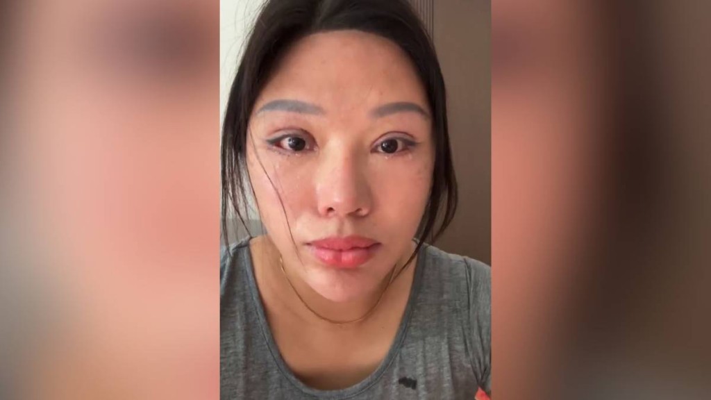 女子接受雙眼皮手術後無法閉眼 涉事無牌醫生被判賠償