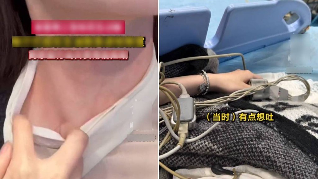 上海女子聲明花生過敏後餐廳仍用花生油 引發醫療費用賠償爭議