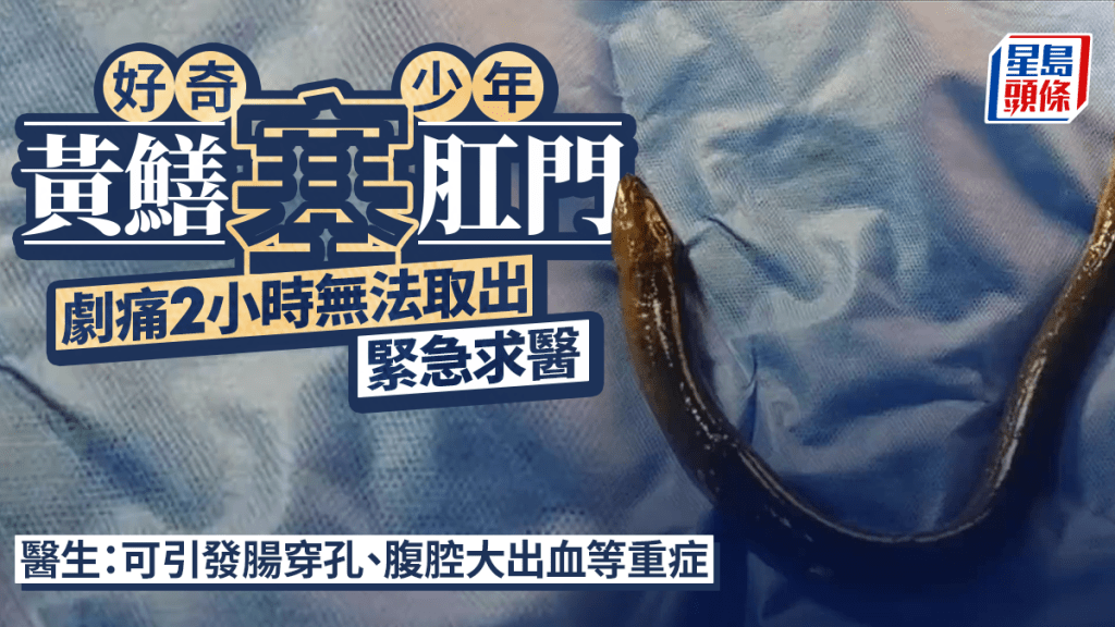 少年誤塞活黃鱔入肛門 醫生緊急手術取出
