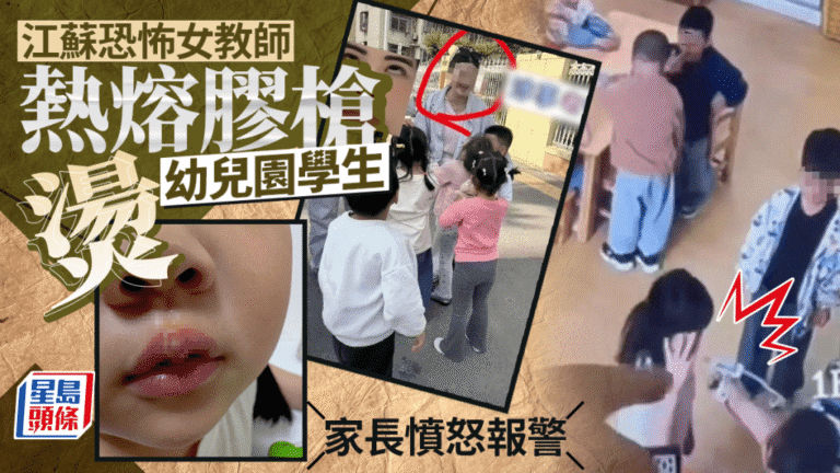江蘇幼稚園教師涉用熱熔膠槍不當對待學童 教育局通報停職調查