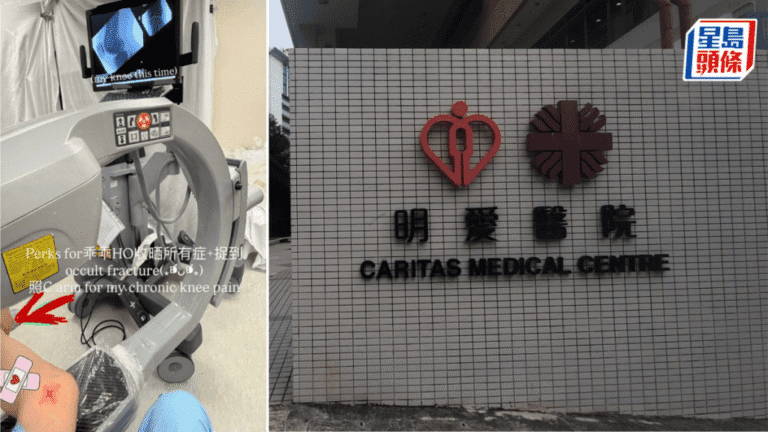 明愛醫院實習醫生未經授權使用X光設備 醫管局展開紀律程序