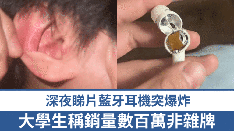 網購熱銷藍牙耳機突爆炸 鄭州大學生耳道內遇險