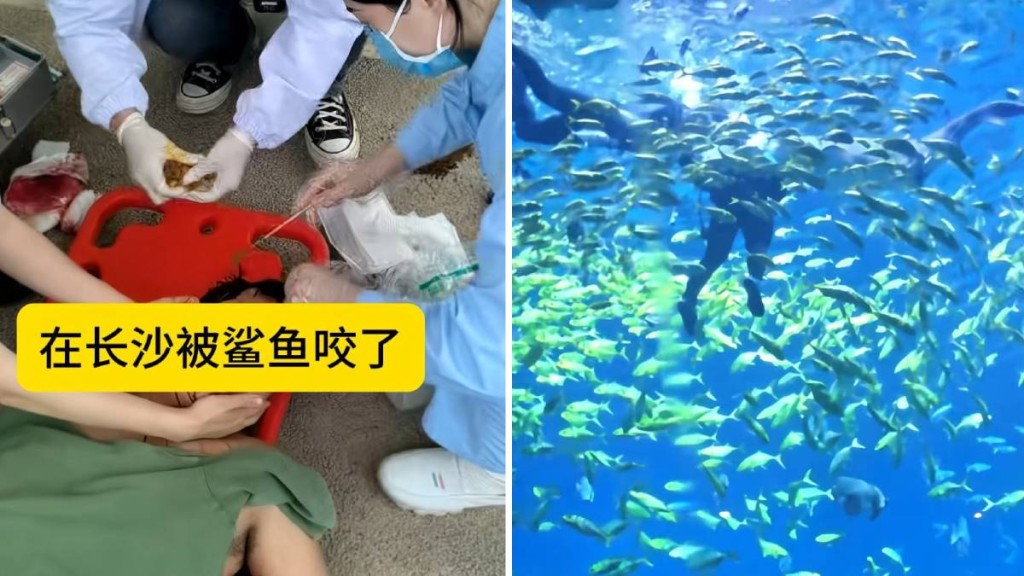 湖南海洋王國潛水活動發生意外 遊客遭鯊魚咬傷面部