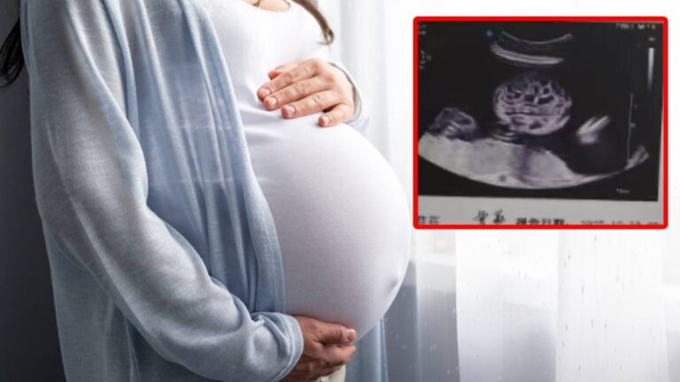 罕見基因缺陷 南京孕婦產檢發現胎兒在子宮內腹瀉