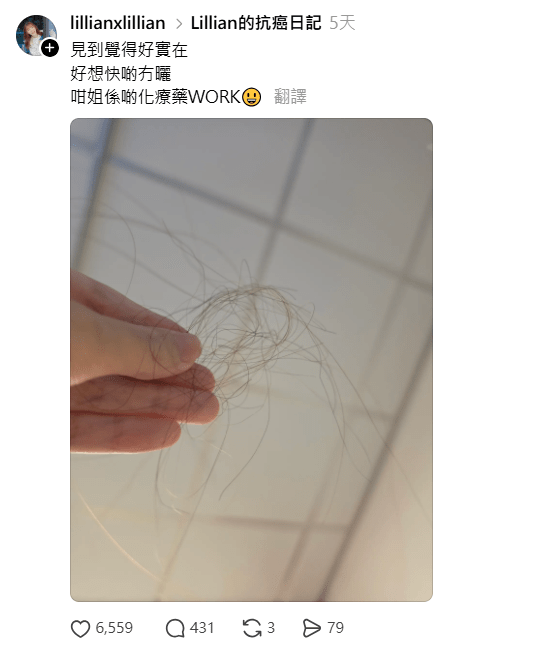 施可瑩接受化療後出現脫髮等副作用。