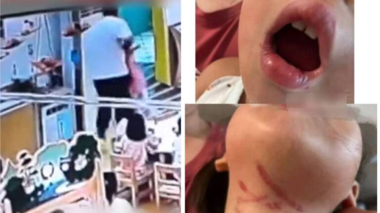 廣東幼稚園男教師涉暴力餵食 3歲女童受傷 涉事教師已被停職拘留