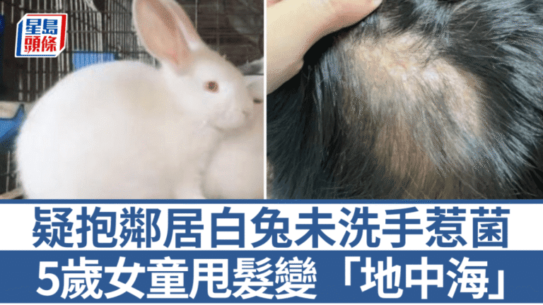 浙江5歲女童接觸寵物兔後頭皮感染真菌，導致永久脫髮