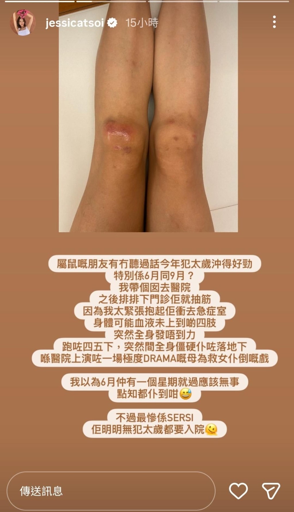 蔡明思因在醫院救女而受傷。