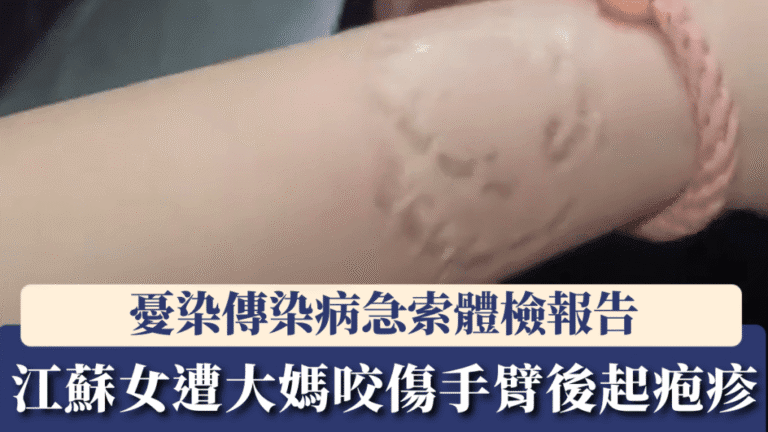 火車霸座糾紛升級 江蘇女乘客遭咬傷後現疱疹 急尋涉事者體檢報告