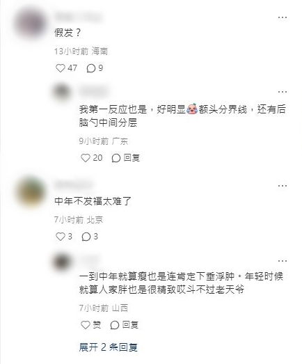 蘇有朋被質疑是否佩戴了假髮。