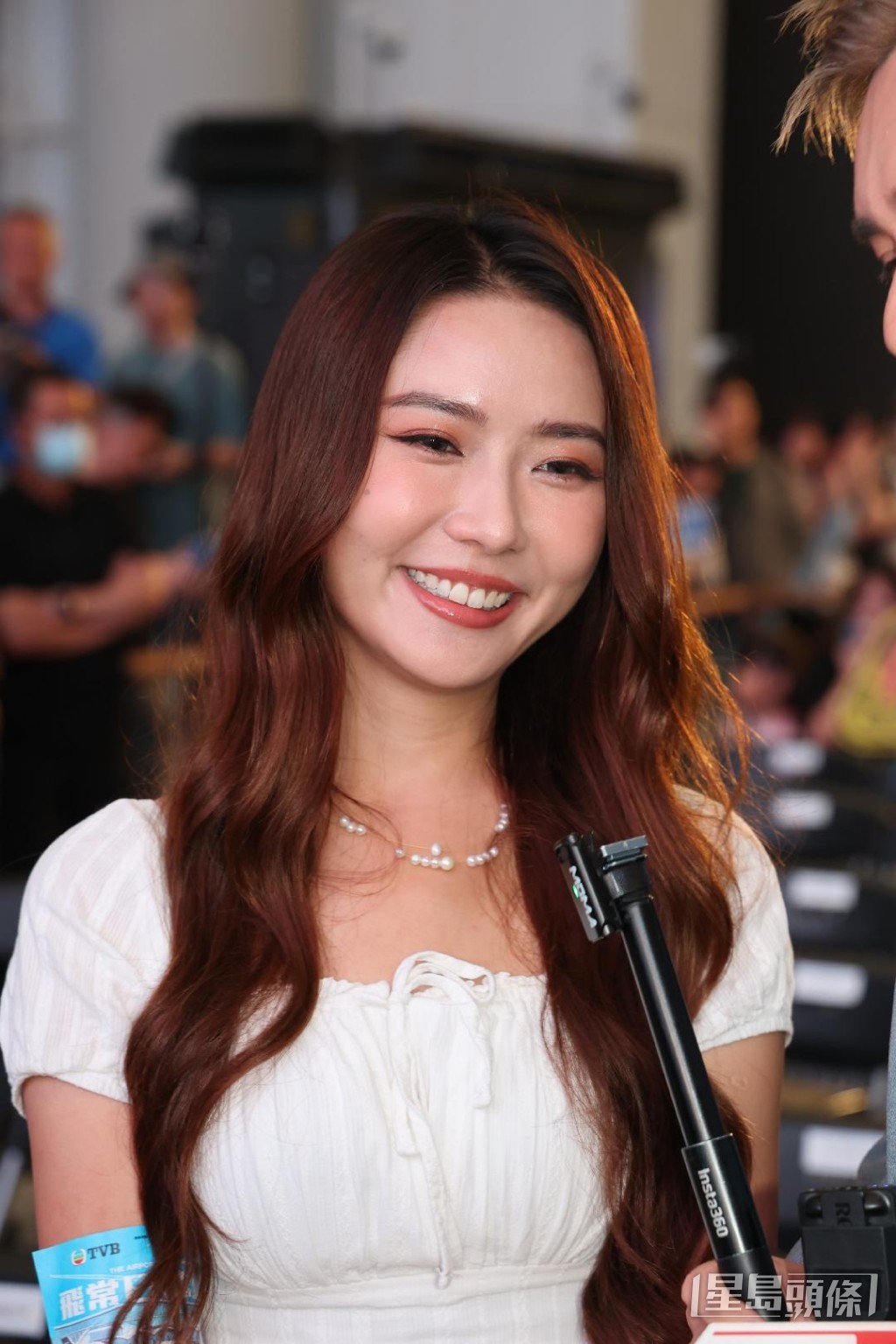 Joey表示門牙缺角尚未請牙醫處理。
