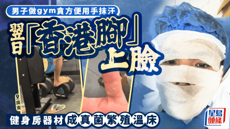 健身室衛生不容忽視 廣東男子徒手擦汗致面部真菌感染