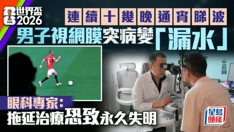 東莞球迷連續熬夜觀看世界盃 引發急性視網膜病變險失明