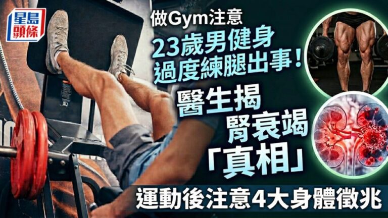健身新手練腿過度 現血尿揭橫紋肌溶解併發腎衰竭
