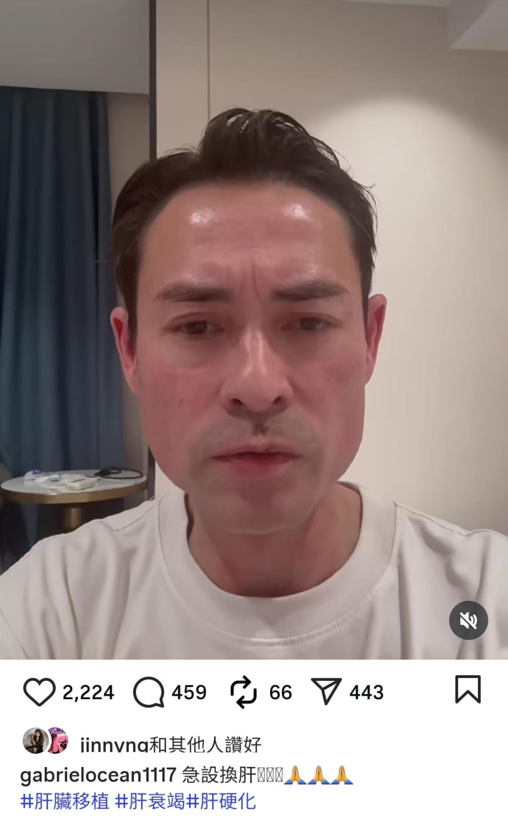海俊傑去年11月8日在Instagram開直播，透露太太需要「急切換肝」。