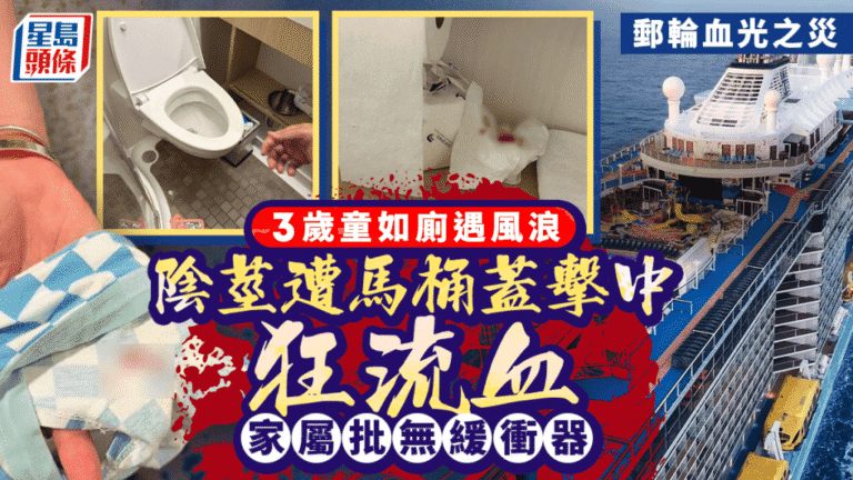 郵輪意外｜海洋光譜號三歲男童如廁時遭馬桶蓋擊傷 家屬質疑安全設計