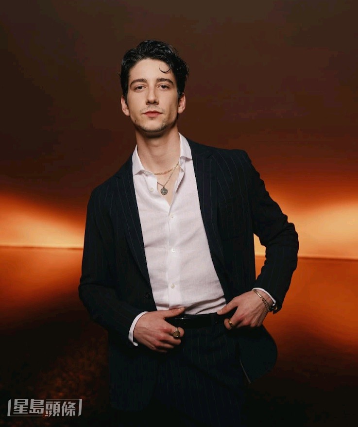 Milo Manheim在獲選後曾表示,接演費林這個經典角色讓他感到壓力頗大。