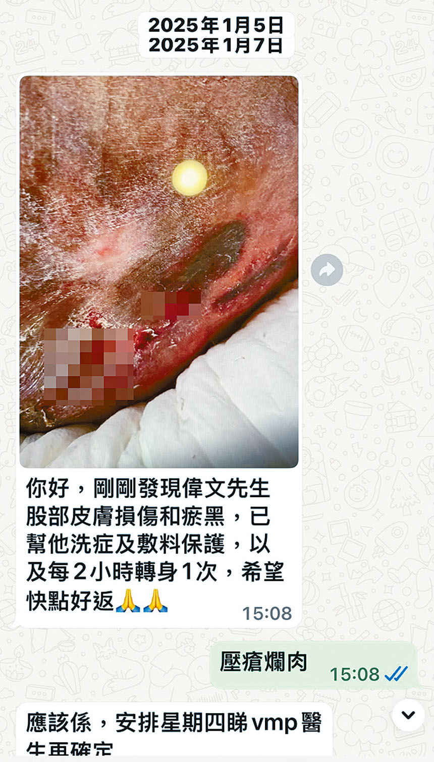 ■去年1月5日,院舍才通知方俊「剛發現」張偉文腰部潰爛,方俊卻指傷口絕非初期壓瘡。