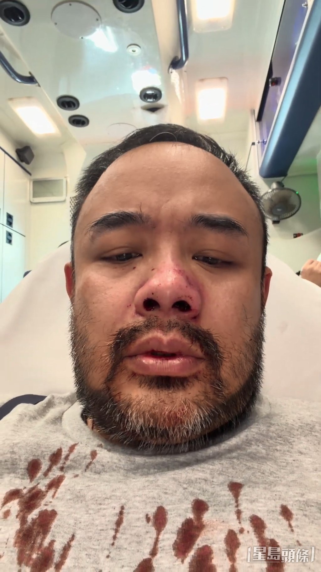 其舊愛邵子風早前在進行直播期間遭到襲擊。